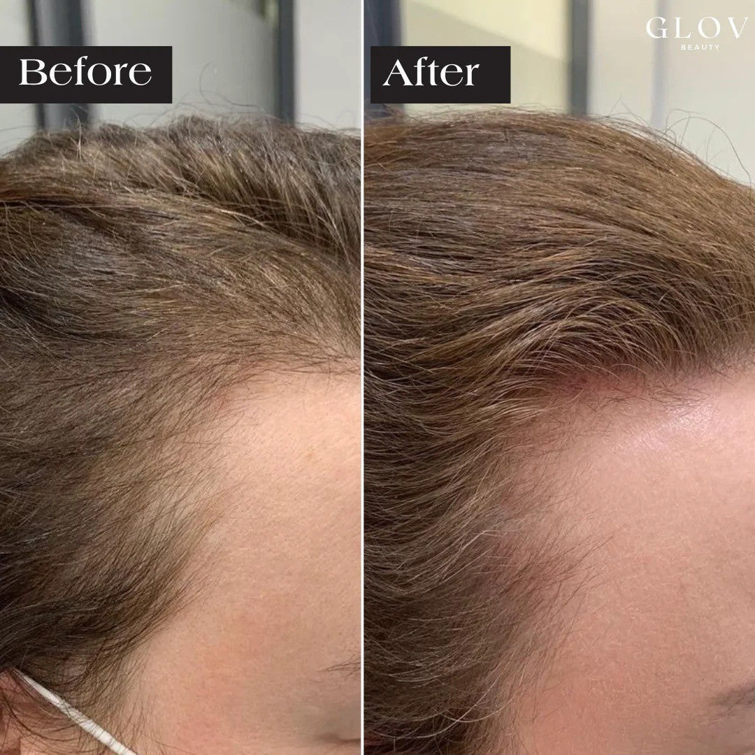 Hair thickening and anti-hair loss essence