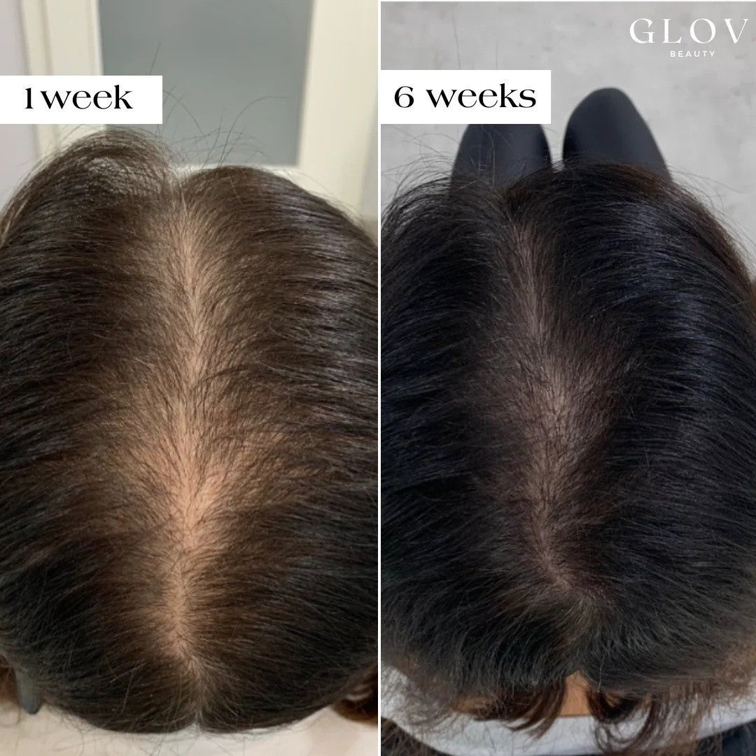 Hair thickening and anti-hair loss essence