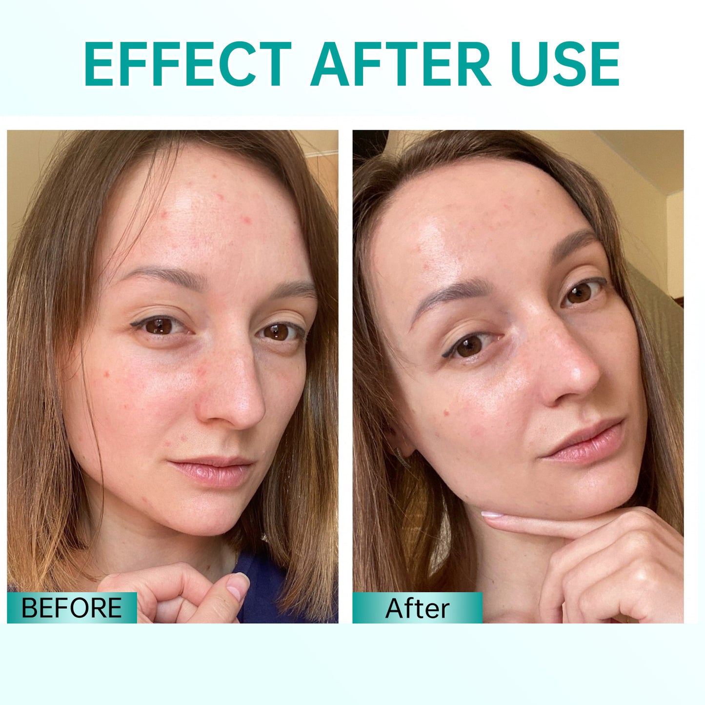 Hyaluronic Acid Moisturizing Cream