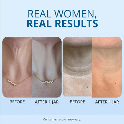 Hydrating and Moisturizing Neck Cream