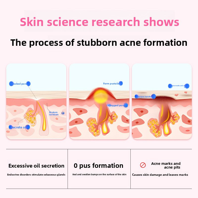 Hydrocolloid Acne Patch Star Shape