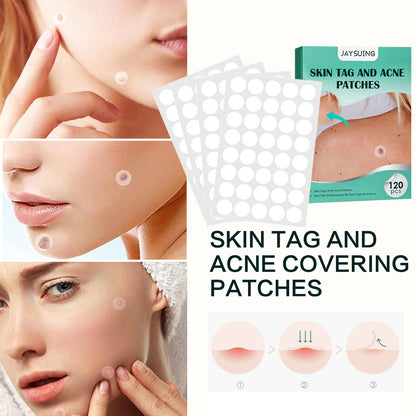Hydrocolloid Acne Patches