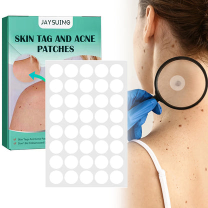 Hydrocolloid Acne Patches