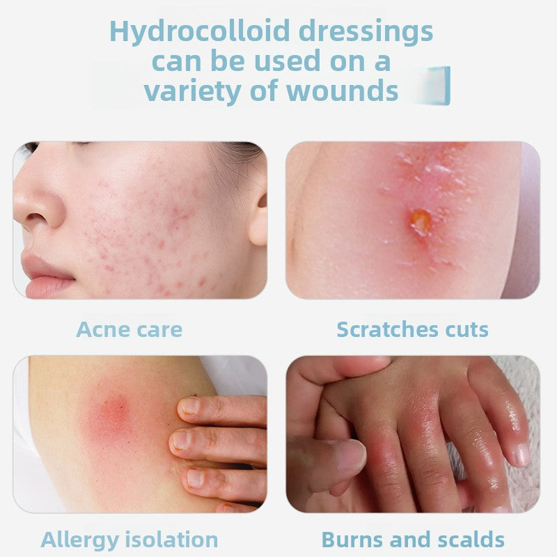 Hydrocolloid Dressing