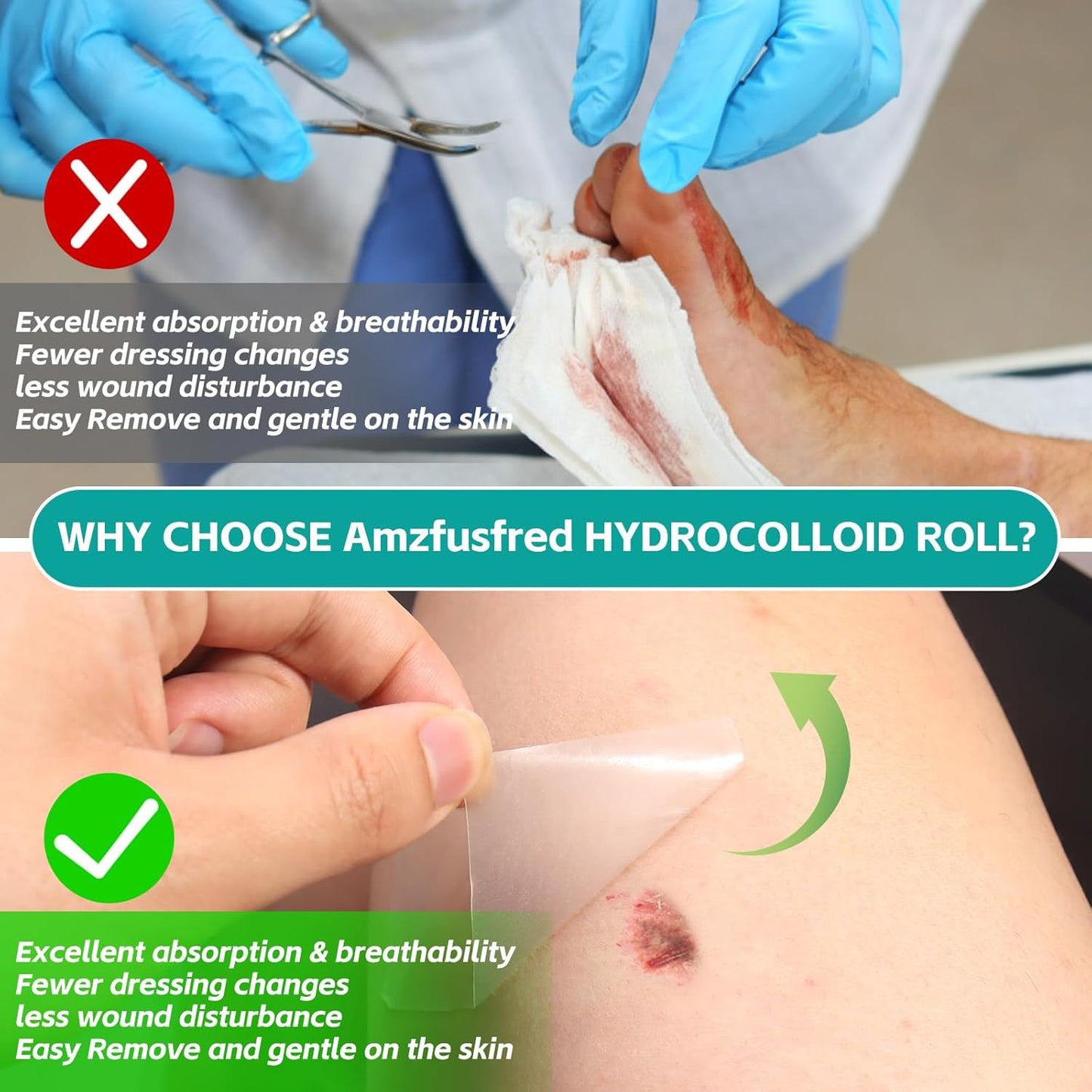 Hydrocolloid Tape Dressing Roll