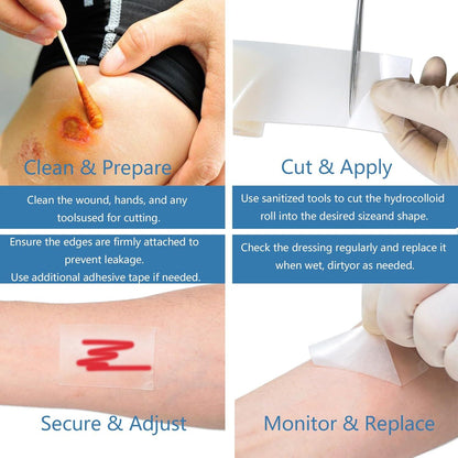 Hydrocolloid Tape Dressing Roll