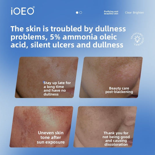 Improvement Dark Spot Essence Lotion