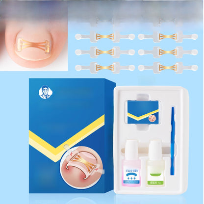 Ingrown Toenail Corrector