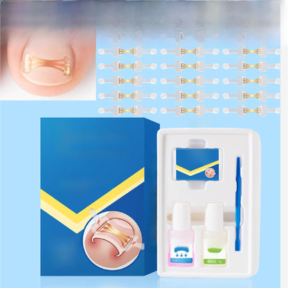 Ingrown Toenail Corrector
