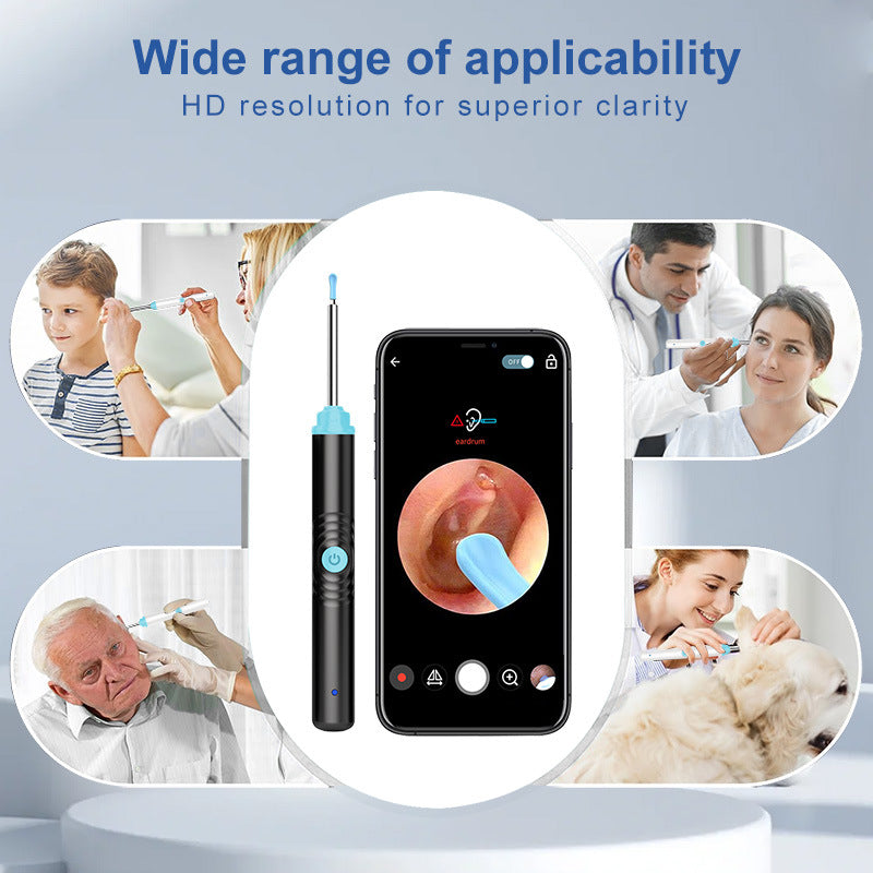 Intelligent visual ear picks