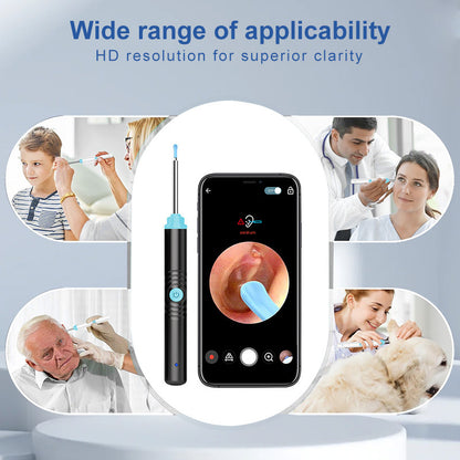 Intelligent visual ear picks