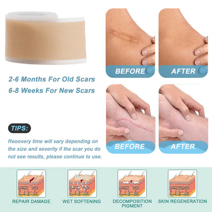 Invisible skin color burn scar care
