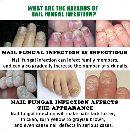 Jaysuing Ginger Nail Care Solution