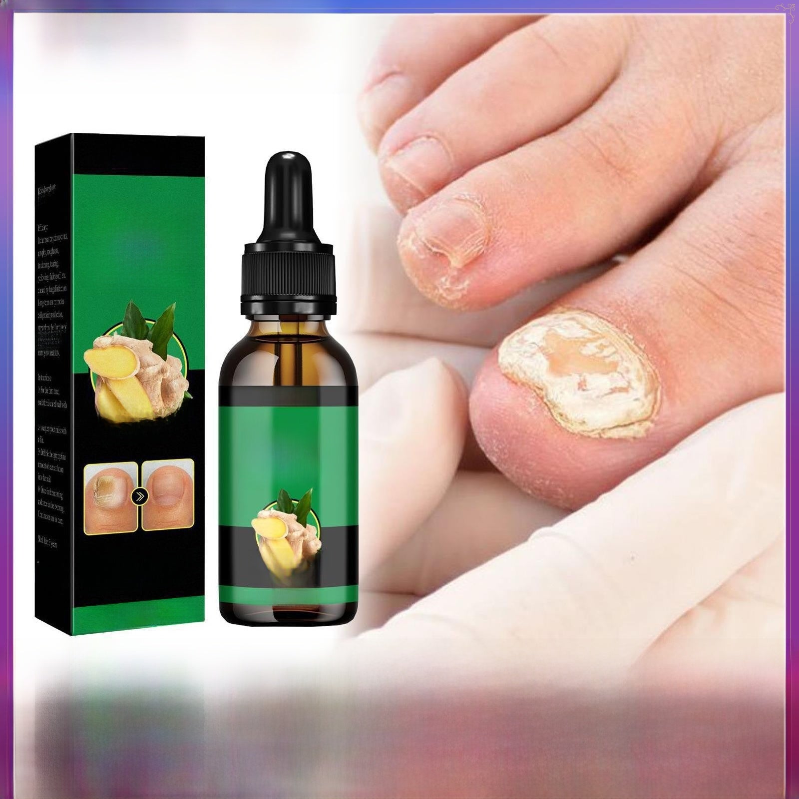 Jaysuing Ginger Nail Care Solution