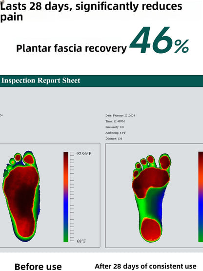 Kandwin Plantar Fascia Pain Relief Foot Massager
