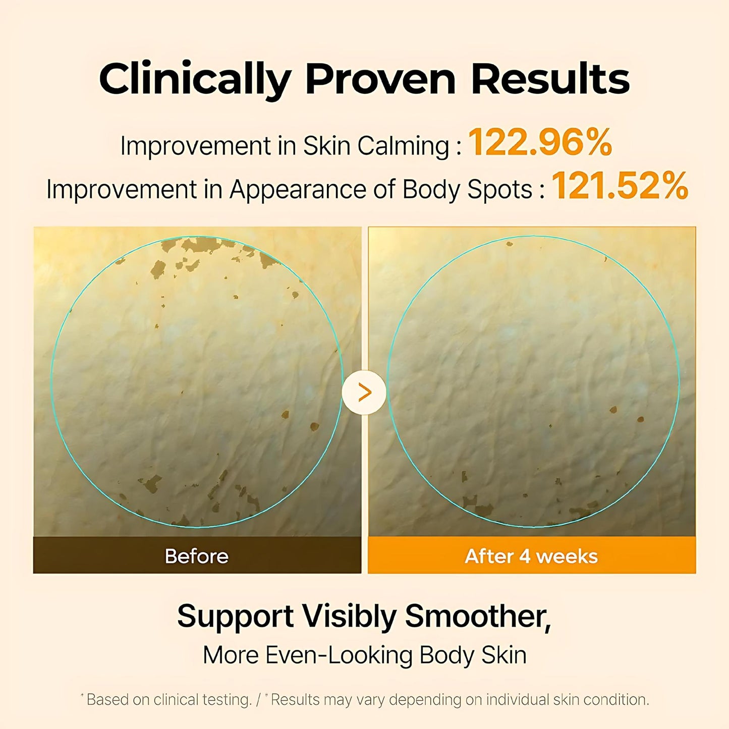 Kojic Acid Turmeric Body Cream