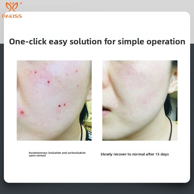 Laser Spot Removal Pen