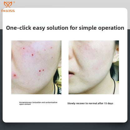 Laser Spot Removal Pen