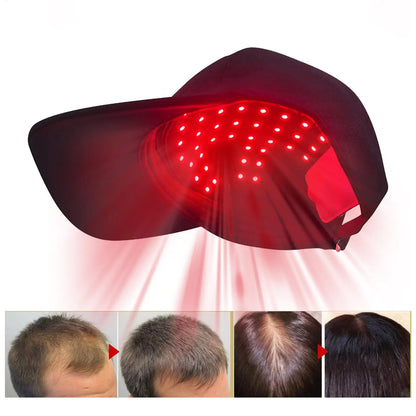 LED hair growth