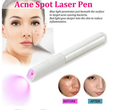 LED Red Blue Light Acne Treatment Pen