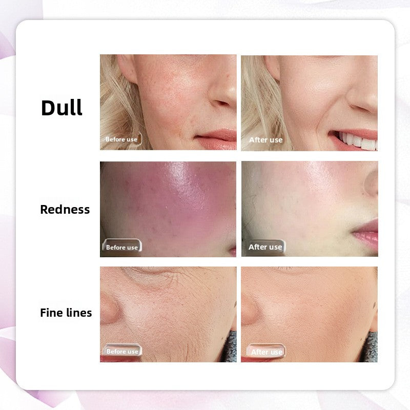 LED Red Light Therapy Facial Mask