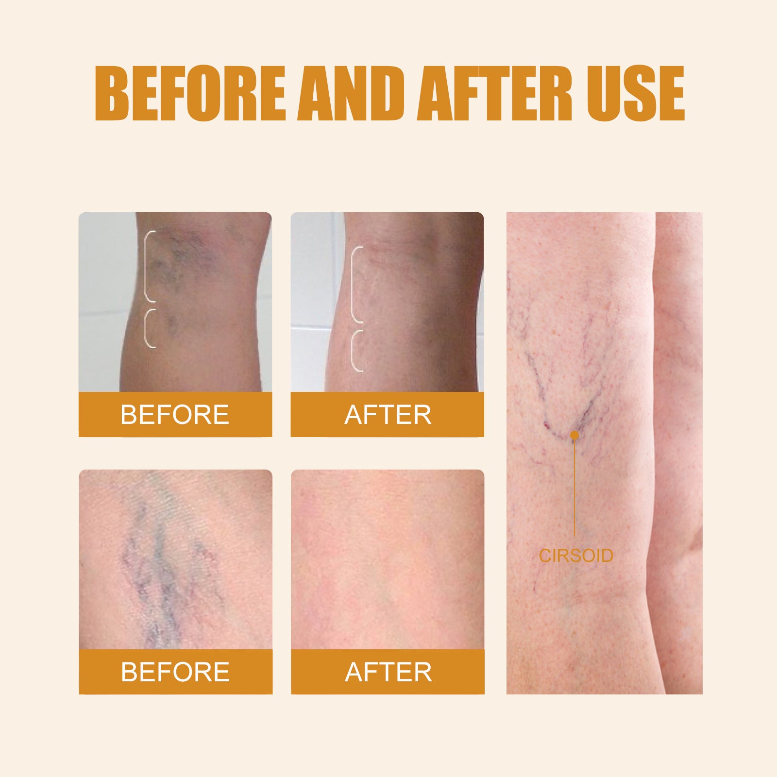 Leg Care Pen