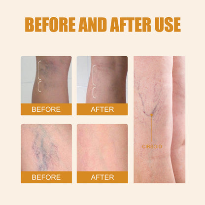 Leg Care Pen