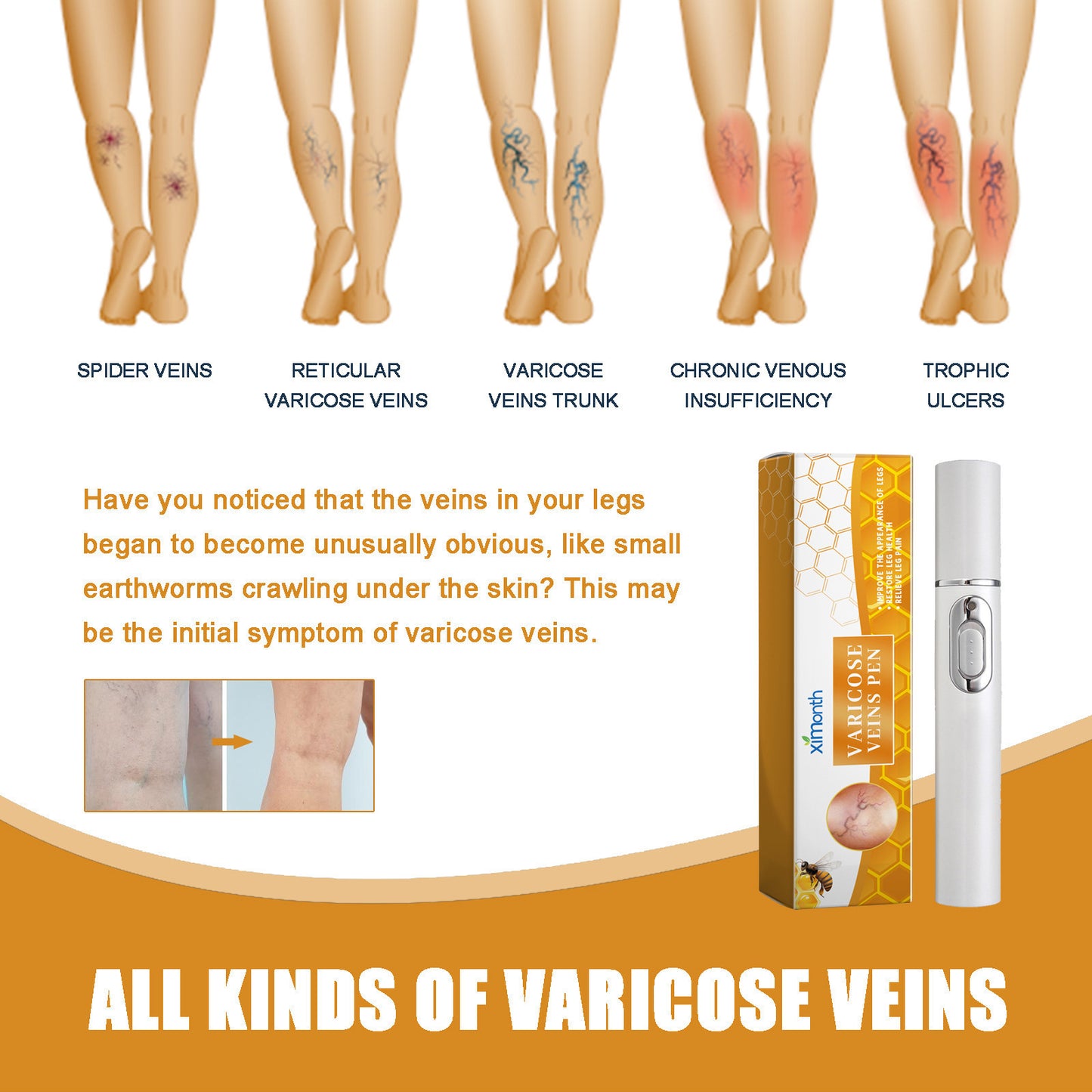 Leg Care Pen