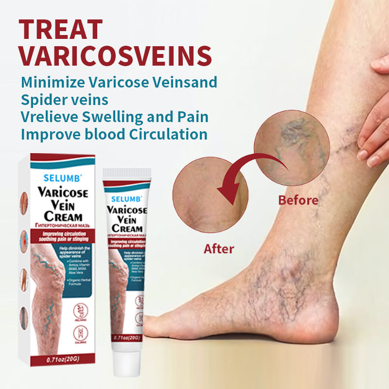Leg Vein Comfort Cooling Gel