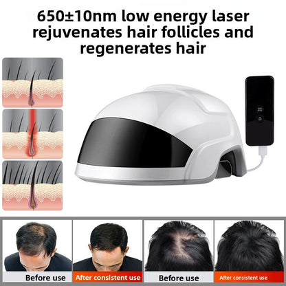 Lescolton Laser Hair Growth Helmet