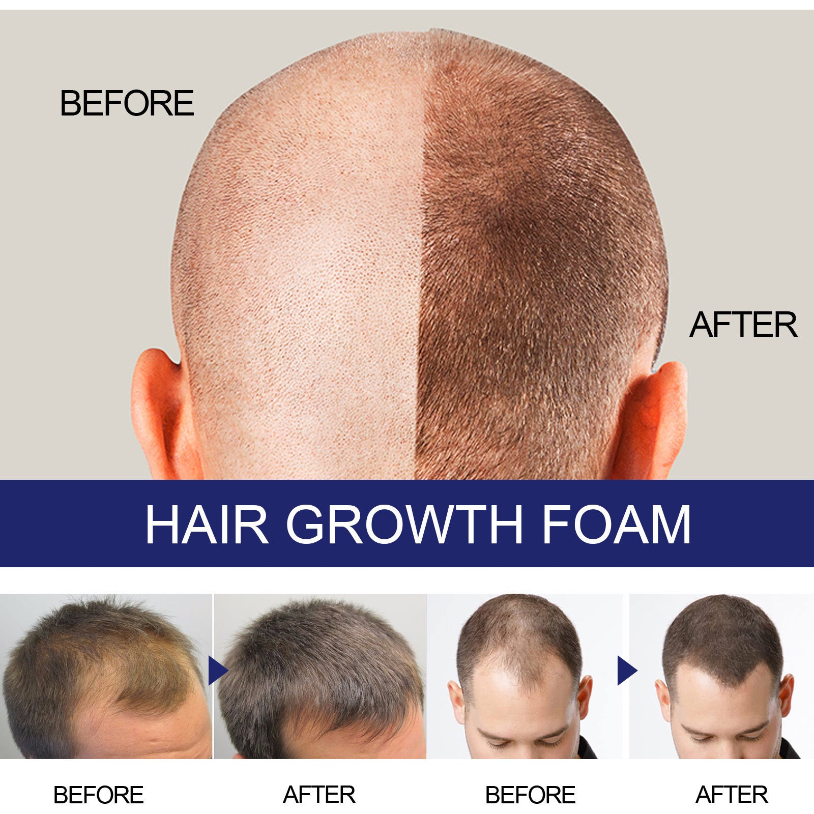Men's Hair Thickening Foam