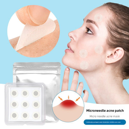 Micro-Needle Acne-Covering Patches