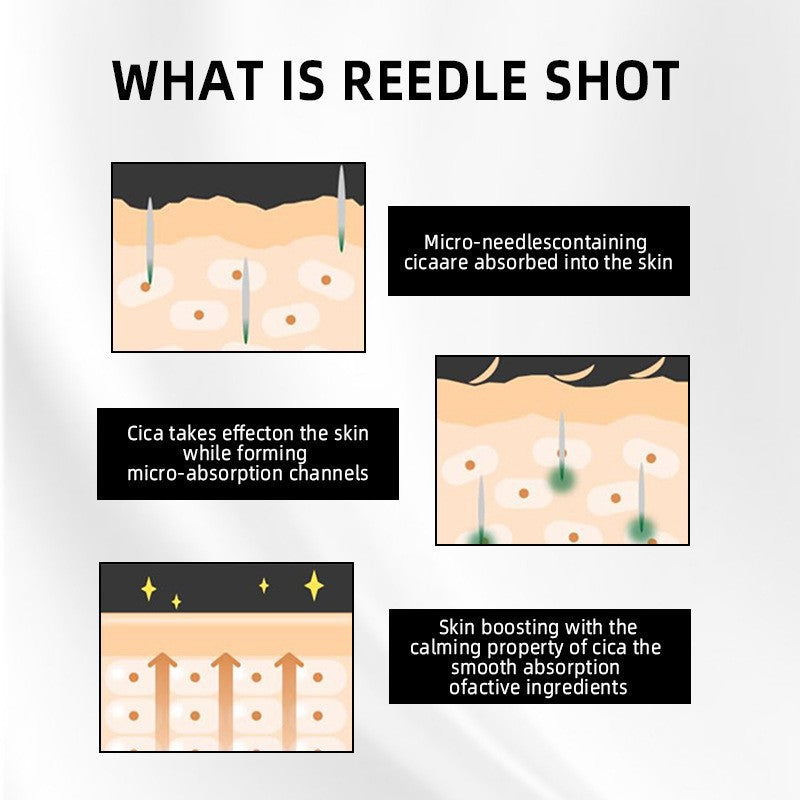 microneedle essence