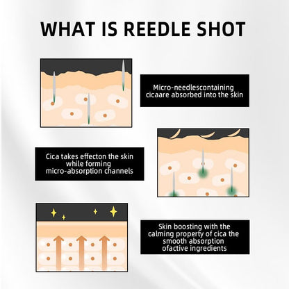 microneedle essence