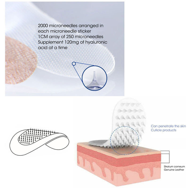 microneedle eye patch