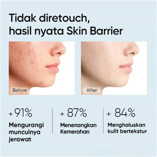 Moisturizing Gel