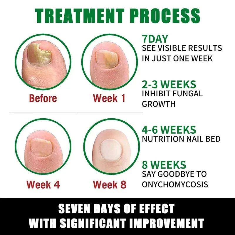 Nail Care Essence