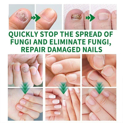 Nail Care Essence