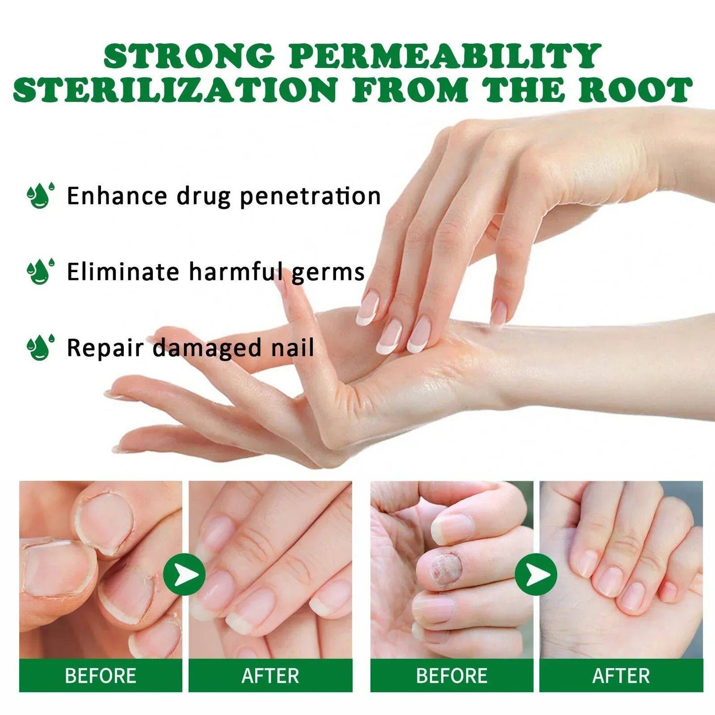 Nail Care Essence