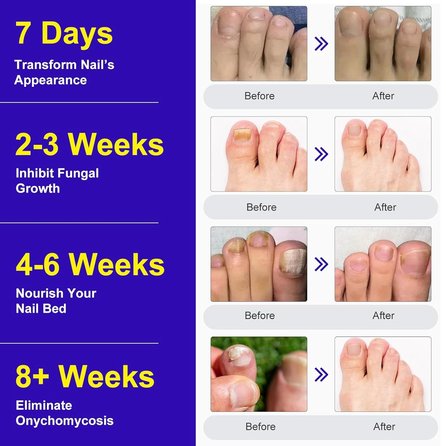 Nail care stickers
