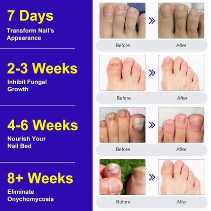 Nail care stickers