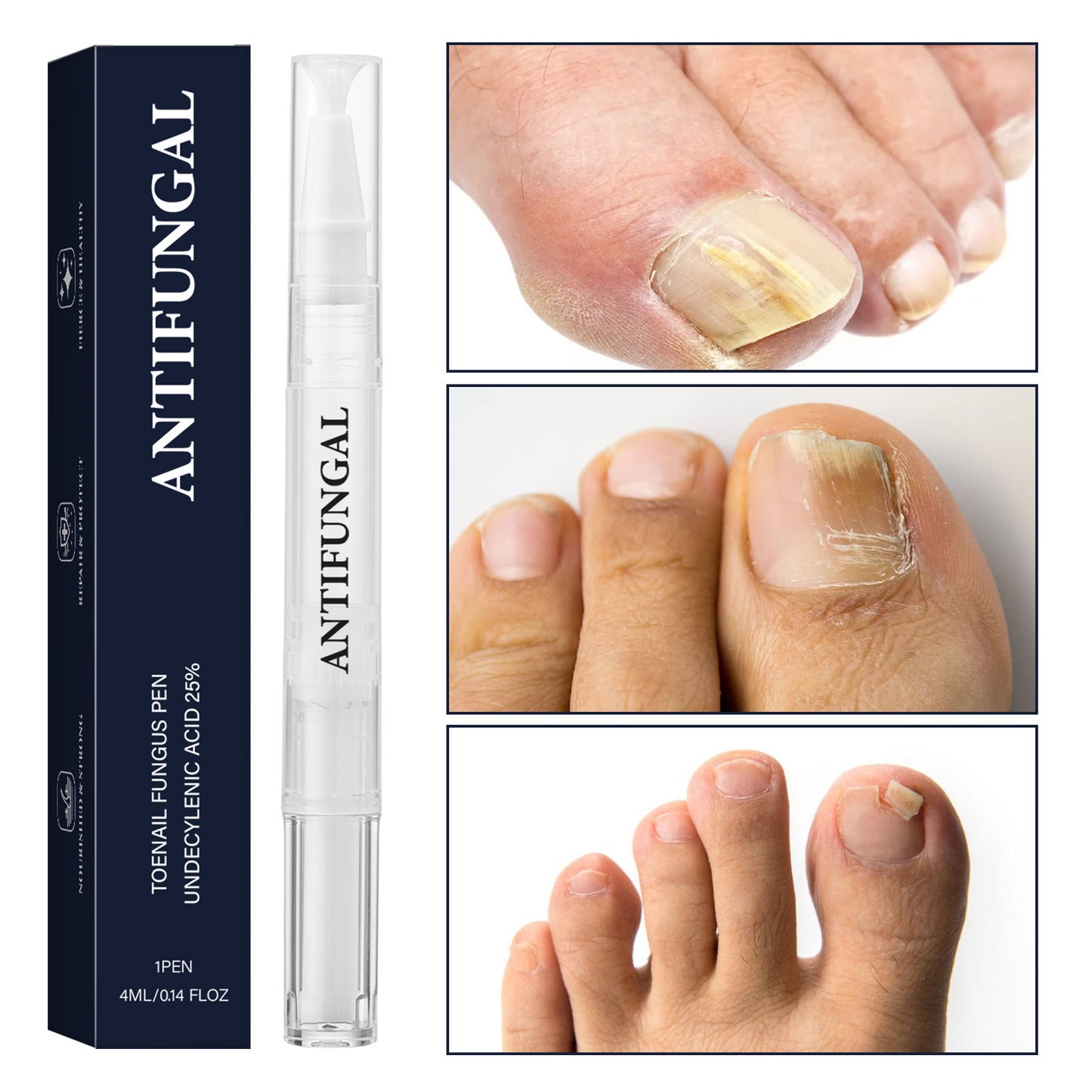 Nail Repair Strengthening Pen