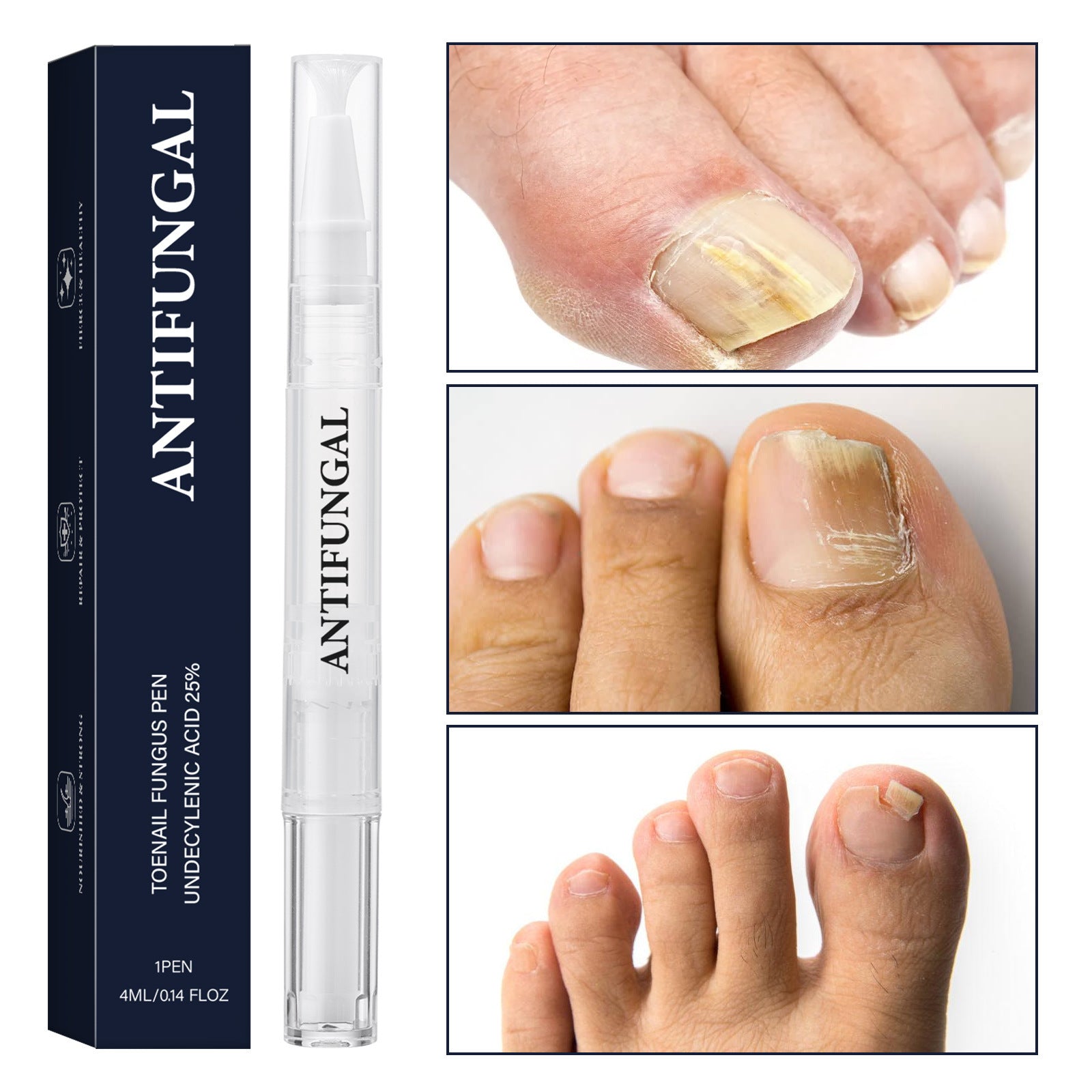 Nail Repair Strengthening Pen