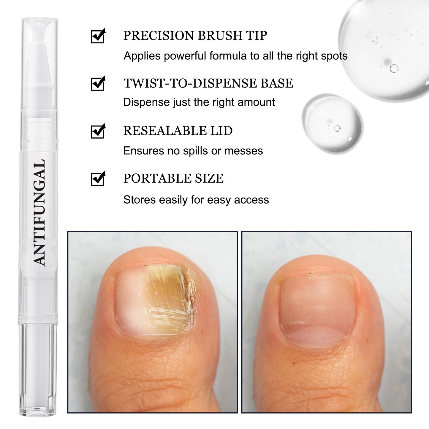 Nail Repair Strengthening Pen
