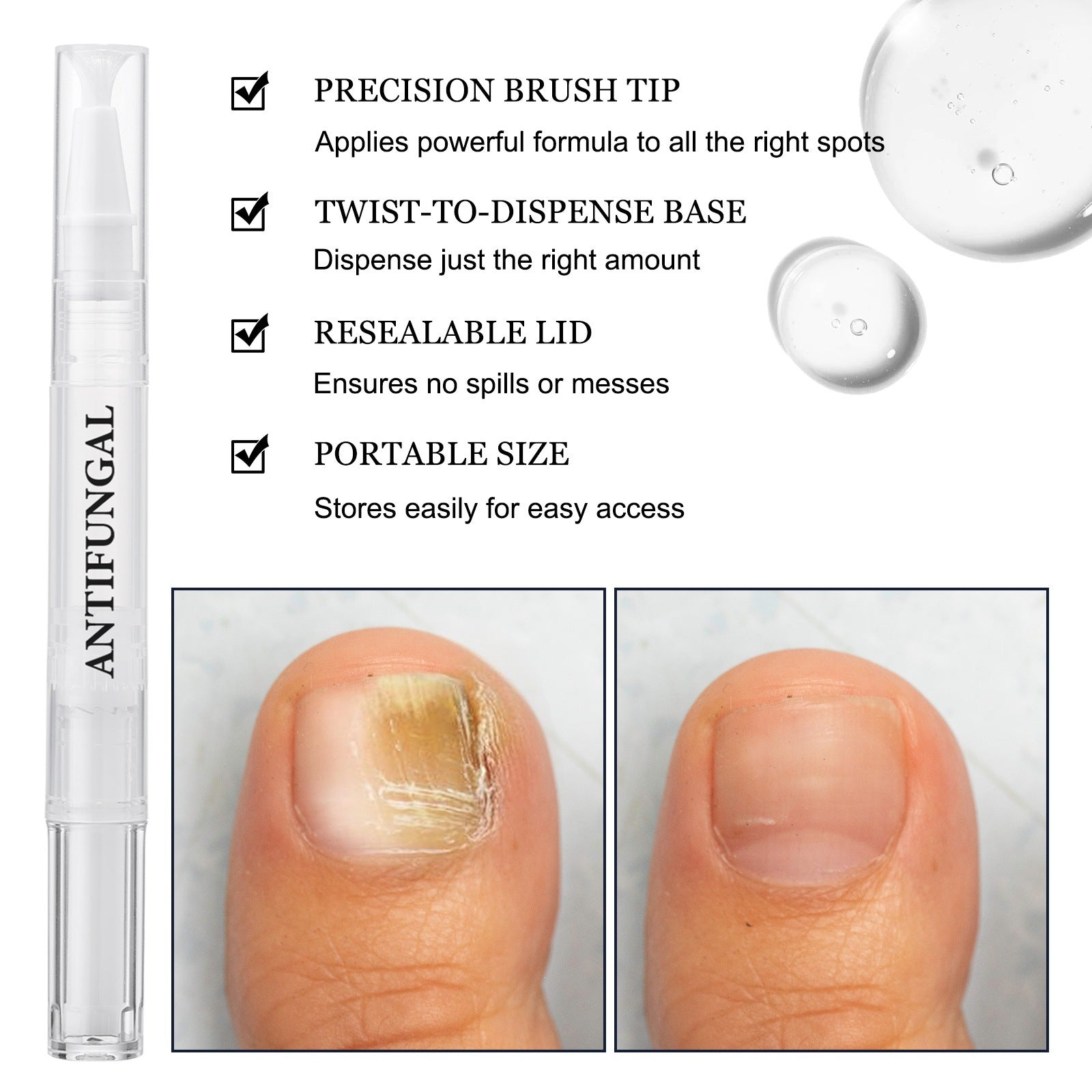 Nail Repair Strengthening Pen