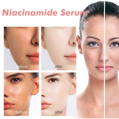 Niacinamide Essence
