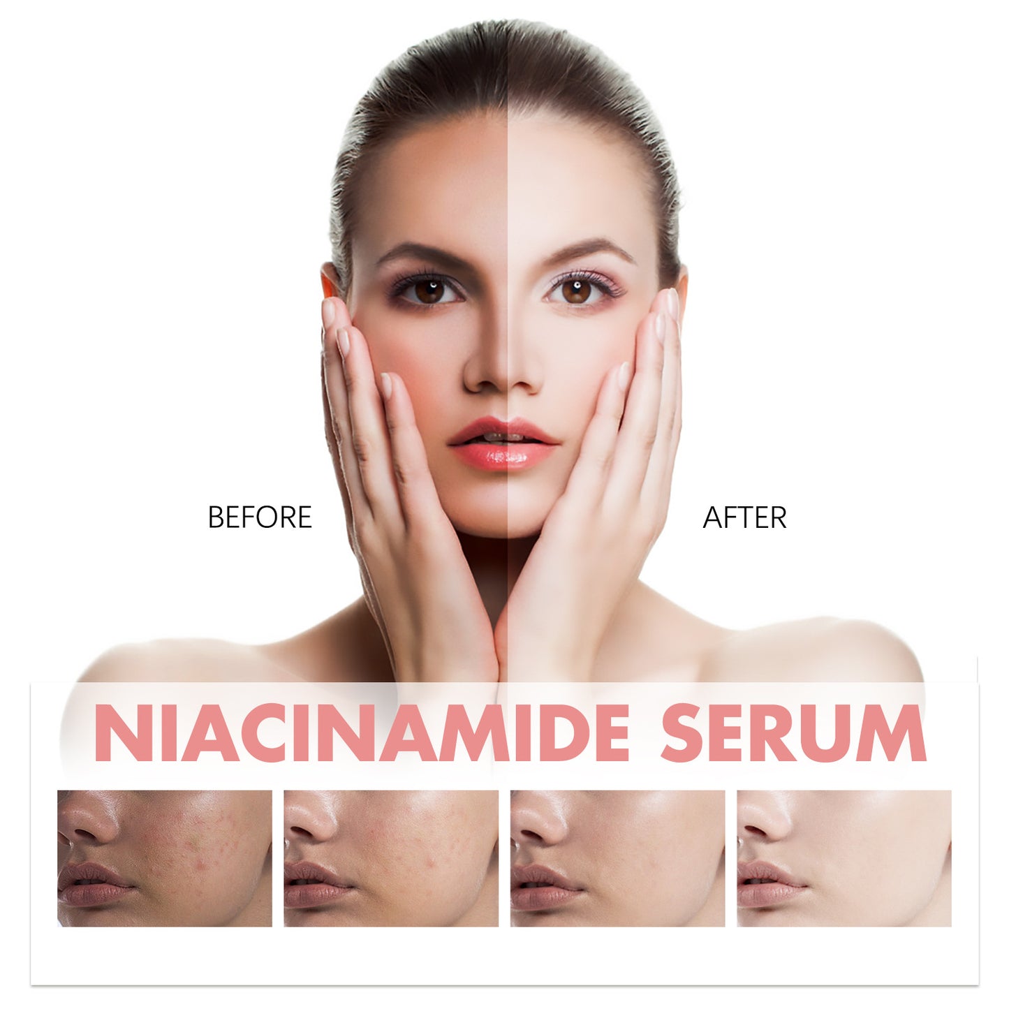 Niacinamide Essence