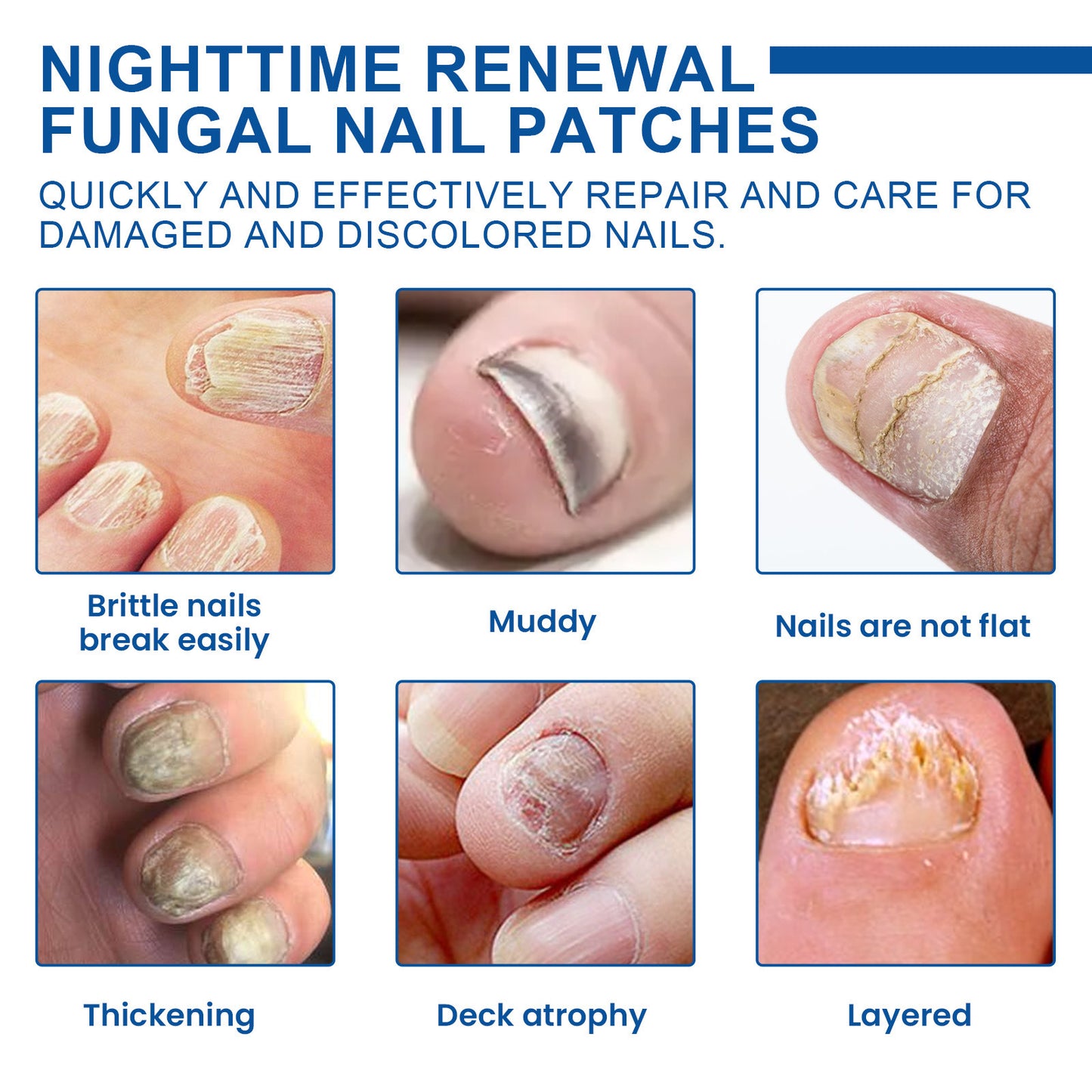 Night Nail Care Repair Thickening Patches