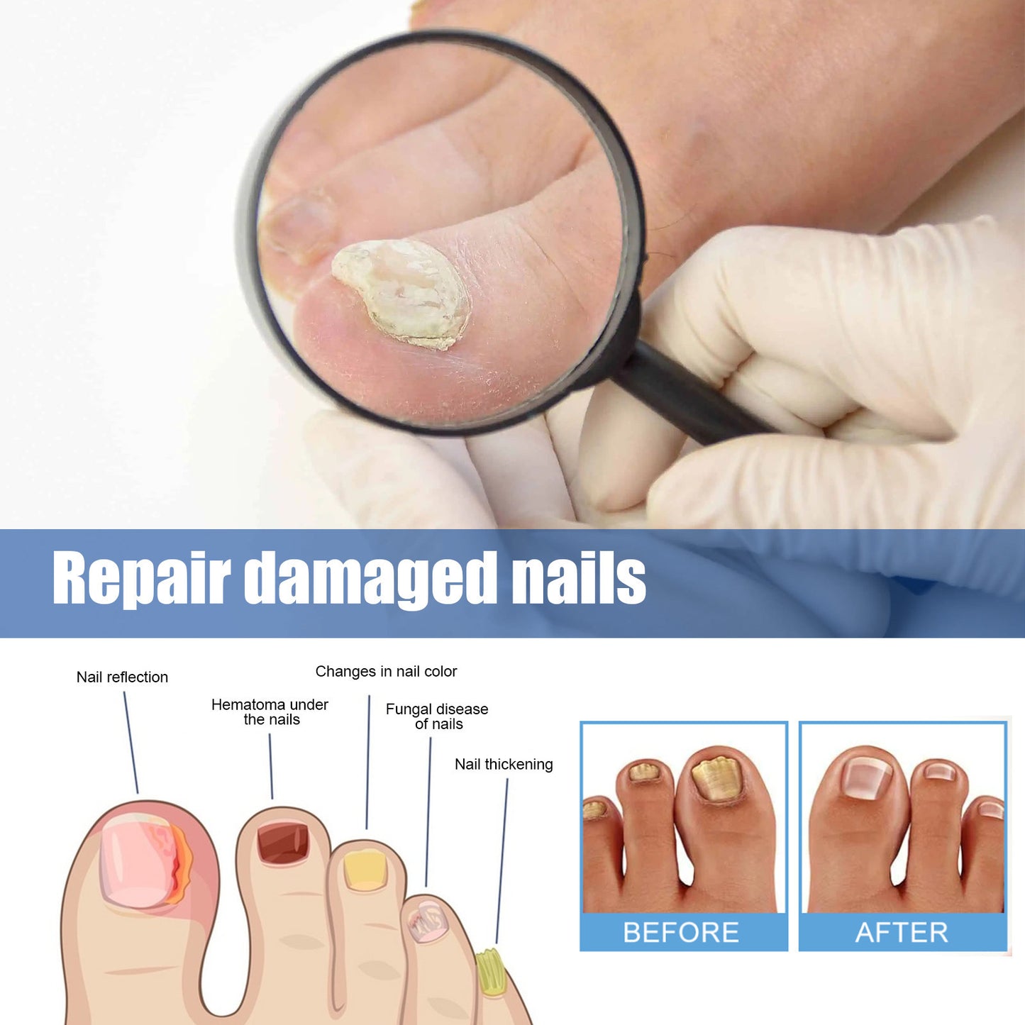 Night Nail Care Repair Thickening Patches