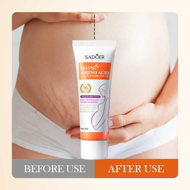 Oatmeal Abdominal Wrinkle Cream